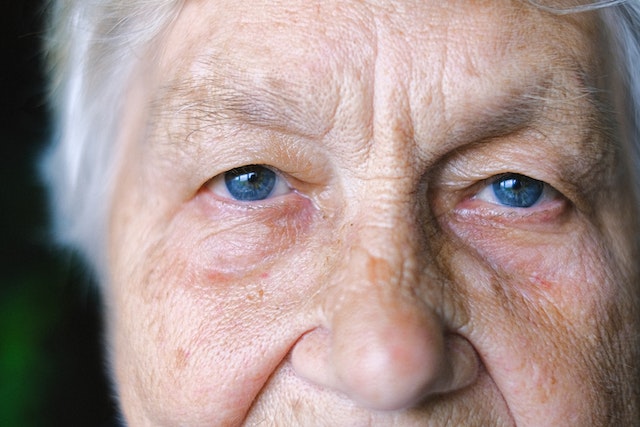 Lire la suite à propos de l’article Vieillissement de la peau : comment le prévenir efficacement ?